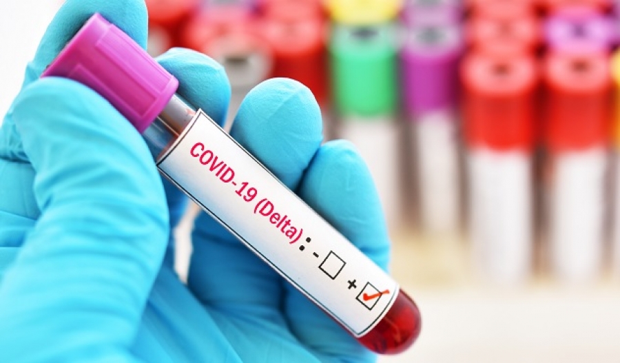 ფოკუსი &ndash; კორონავირუსის &laquo;დელტა&raquo; შტამი